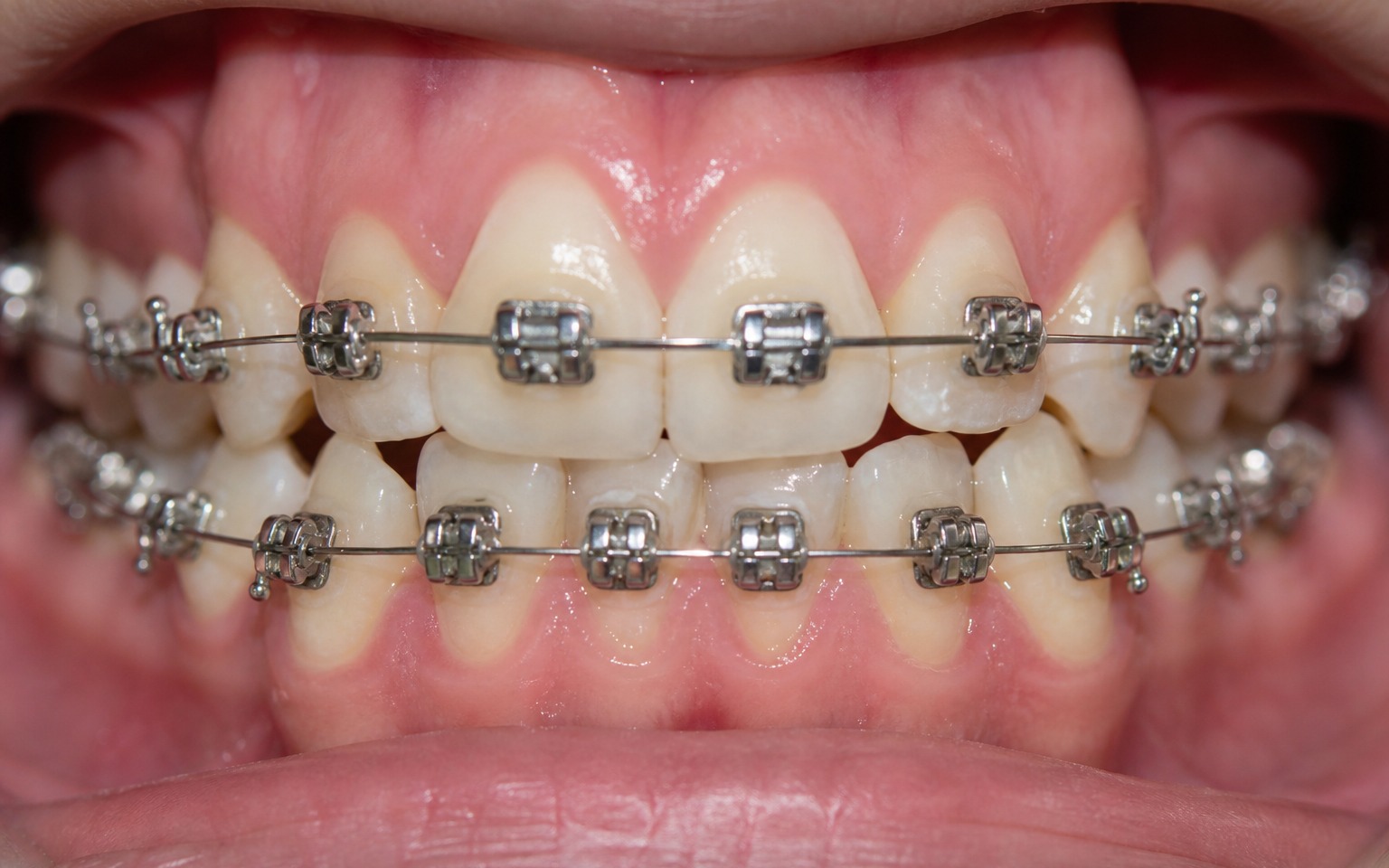 Before treatment
